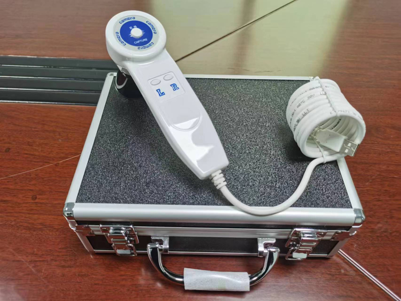 5,0-MP-Digital-Iridologie-Kame – Qh Furnitures Bewertung und Preis